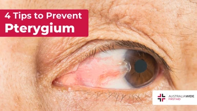 Prevent pterygium article header – First Aid Article in Narre Warren